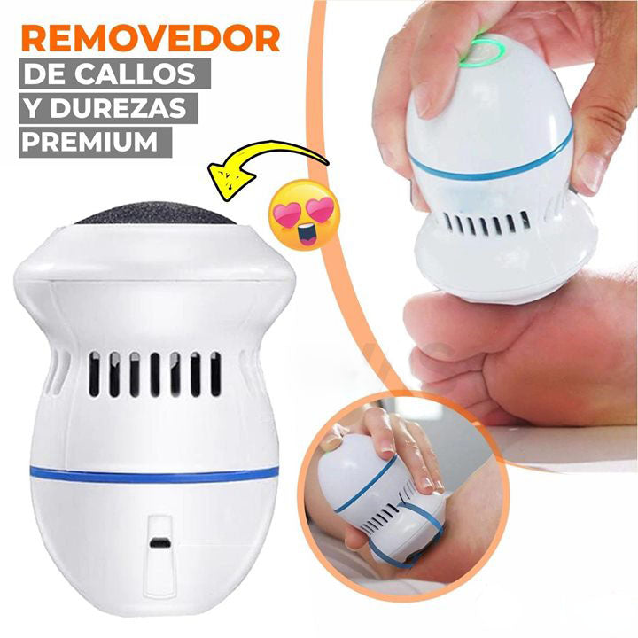 Removedor de Callos: ¡La Solución para Pies Suaves y Cuidados!