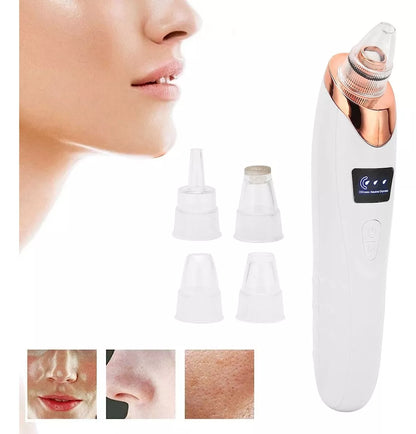 Máquina Extractor de Puntos Negros: ¡Piel Limpia y Radiante al Instante!